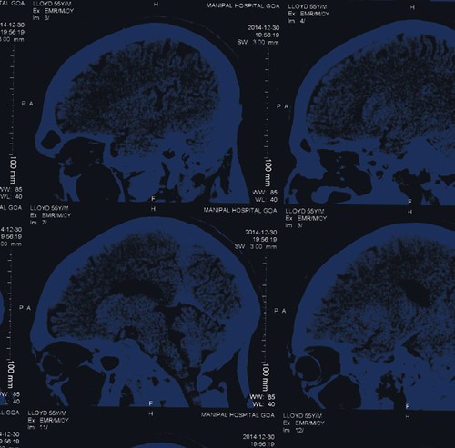 Nightingales - Mind Over Matter in the group VINYL / Rock at Bengans Skivbutik AB (1318417)