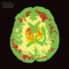 Minus 5 The - Stroke Manor