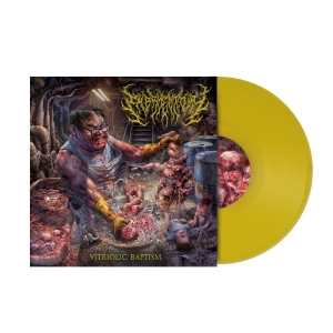 Embryectomy - Vitriolic Baptism