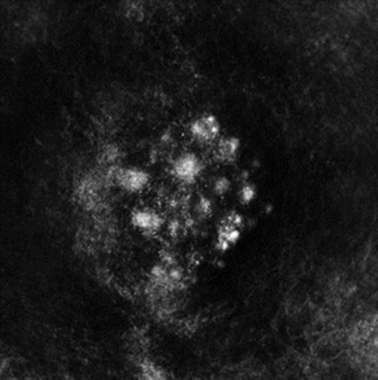 Saffronkeira - Synecdoche